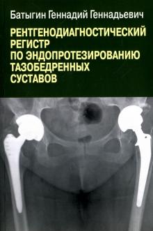 Рентгенограф.регистр по эндопрот.тазобедр.суставов